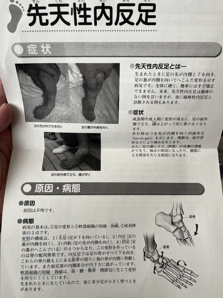 先天性内反足の診断1
