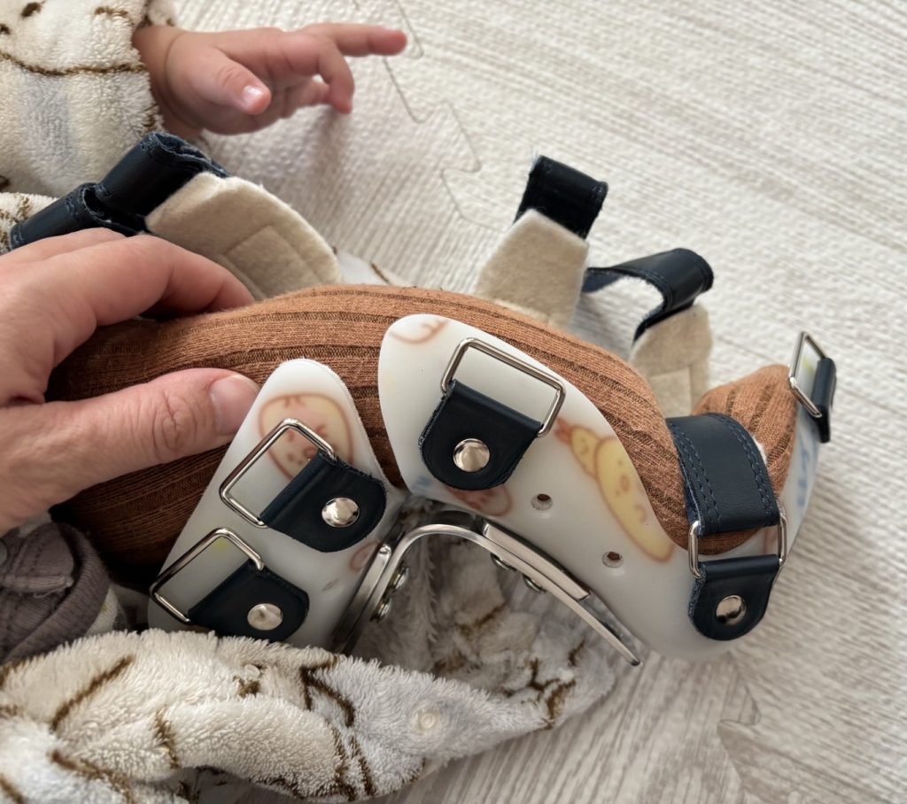 装具のサイズが合ってない2