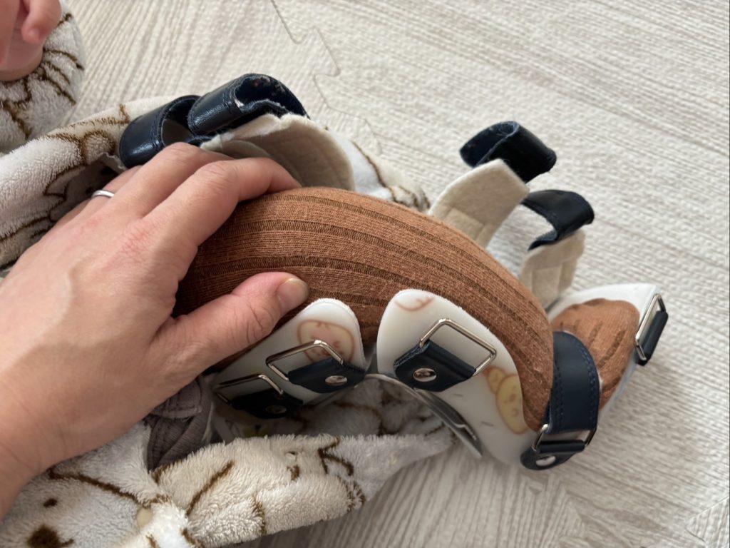 装具のサイズが合ってない1