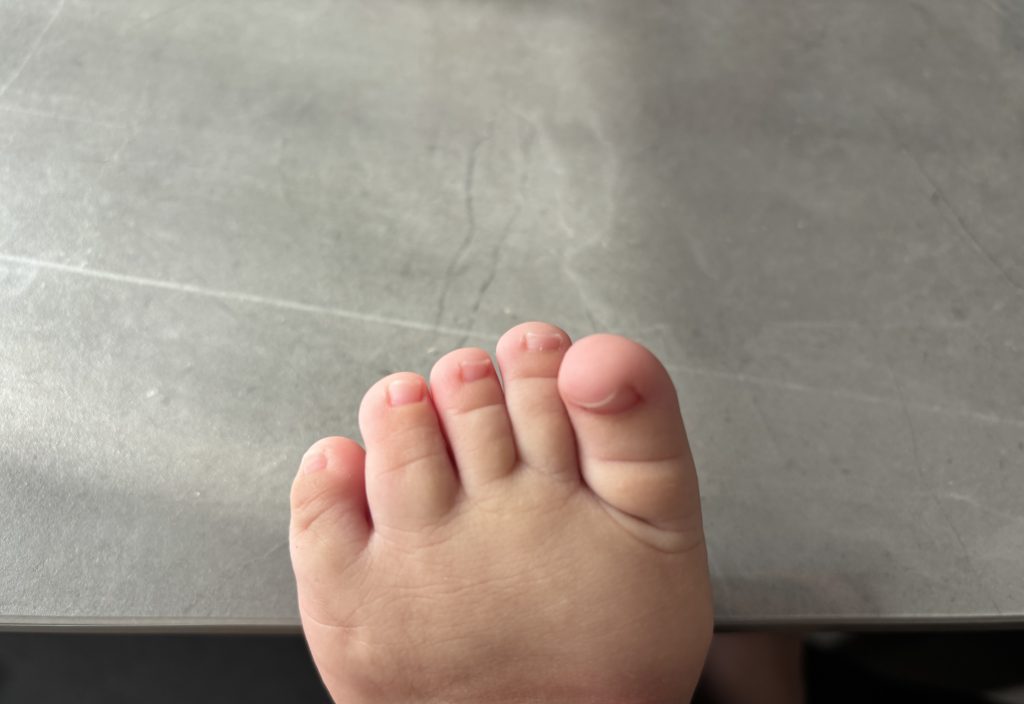 指の形がよくなった？1