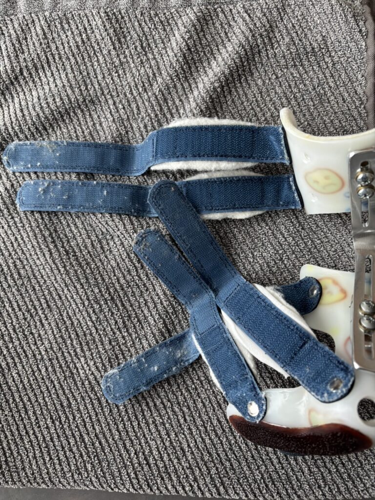 マジックテープ(清掃前)