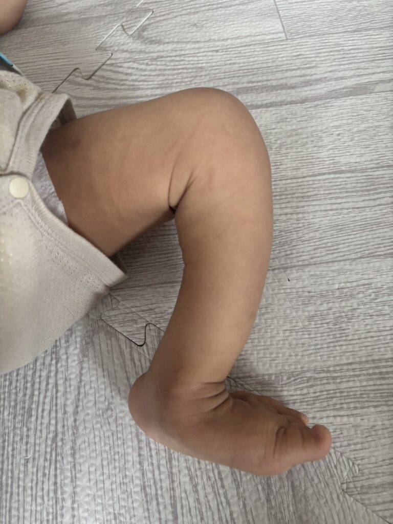 左脚（膝曲げ）