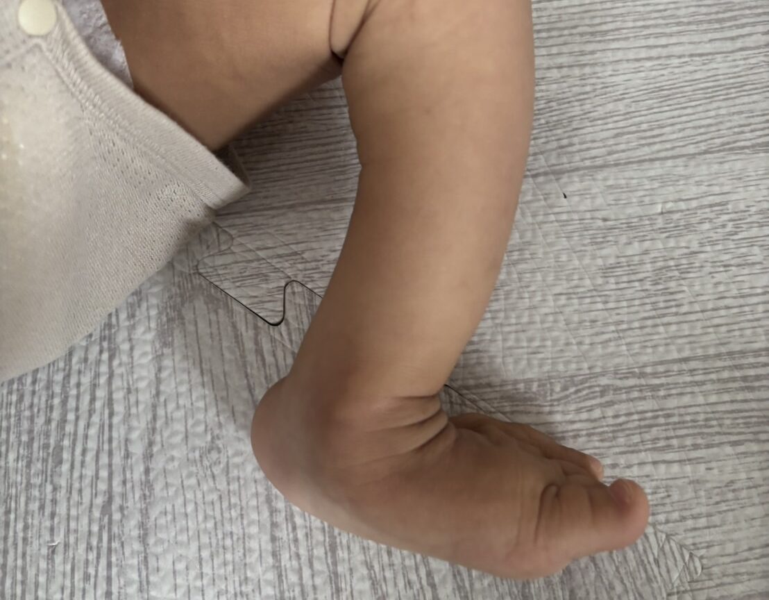 左脚（膝曲げ）