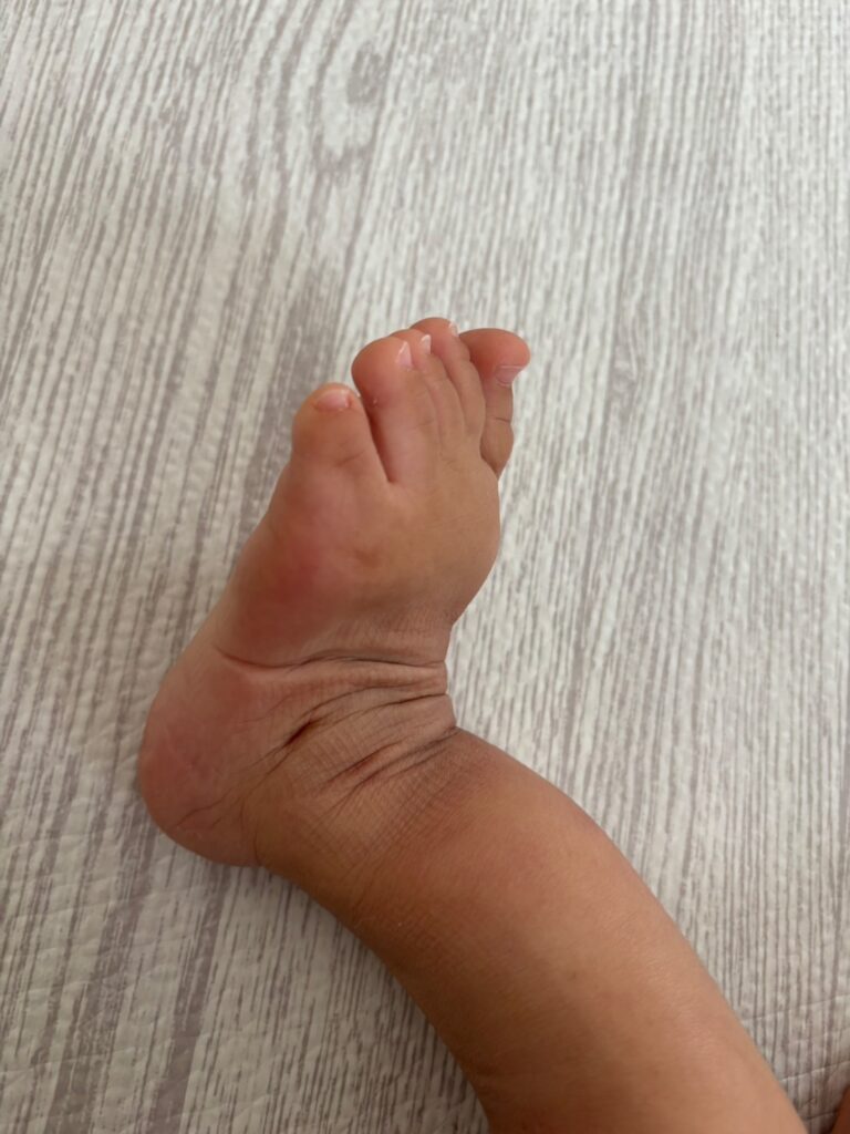 ベルト部分の凹み