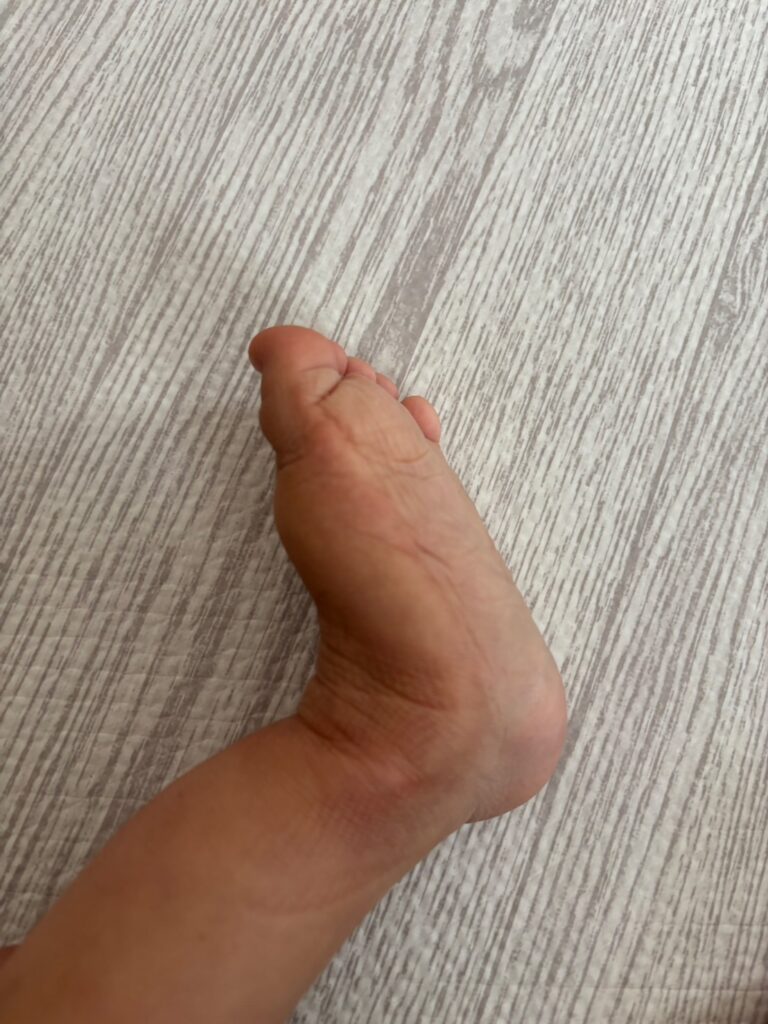 足裏が平らになってきた