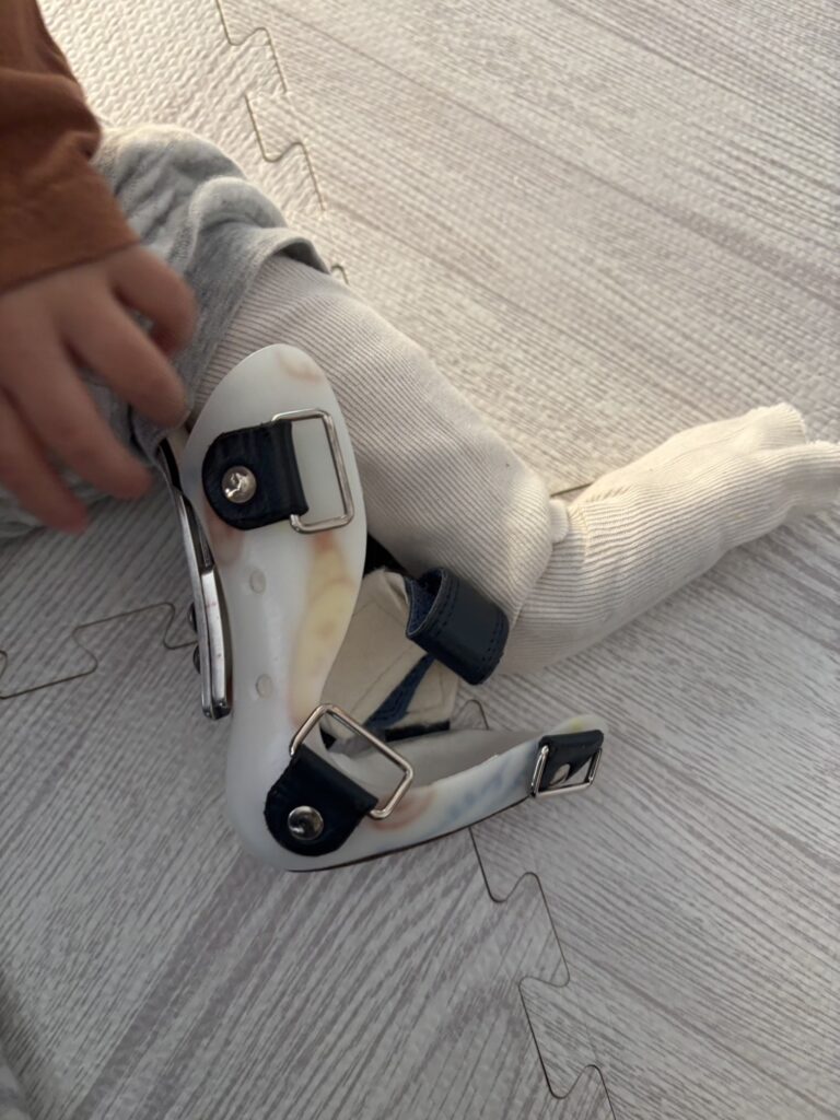 装具外して立ってた3