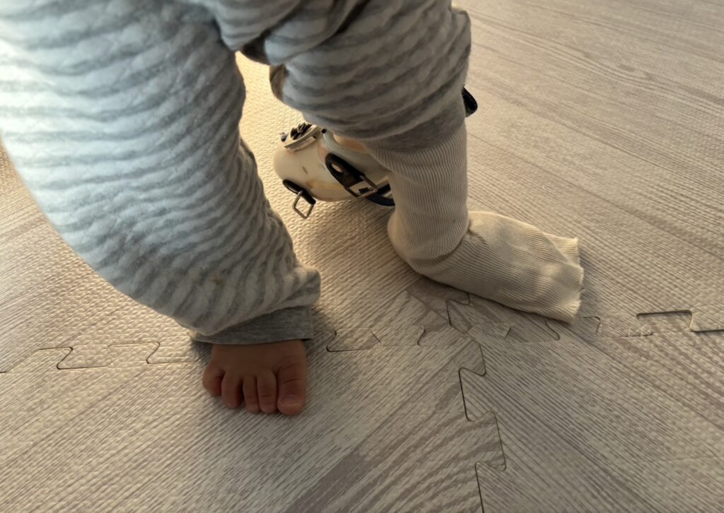 装具外して立ってた1