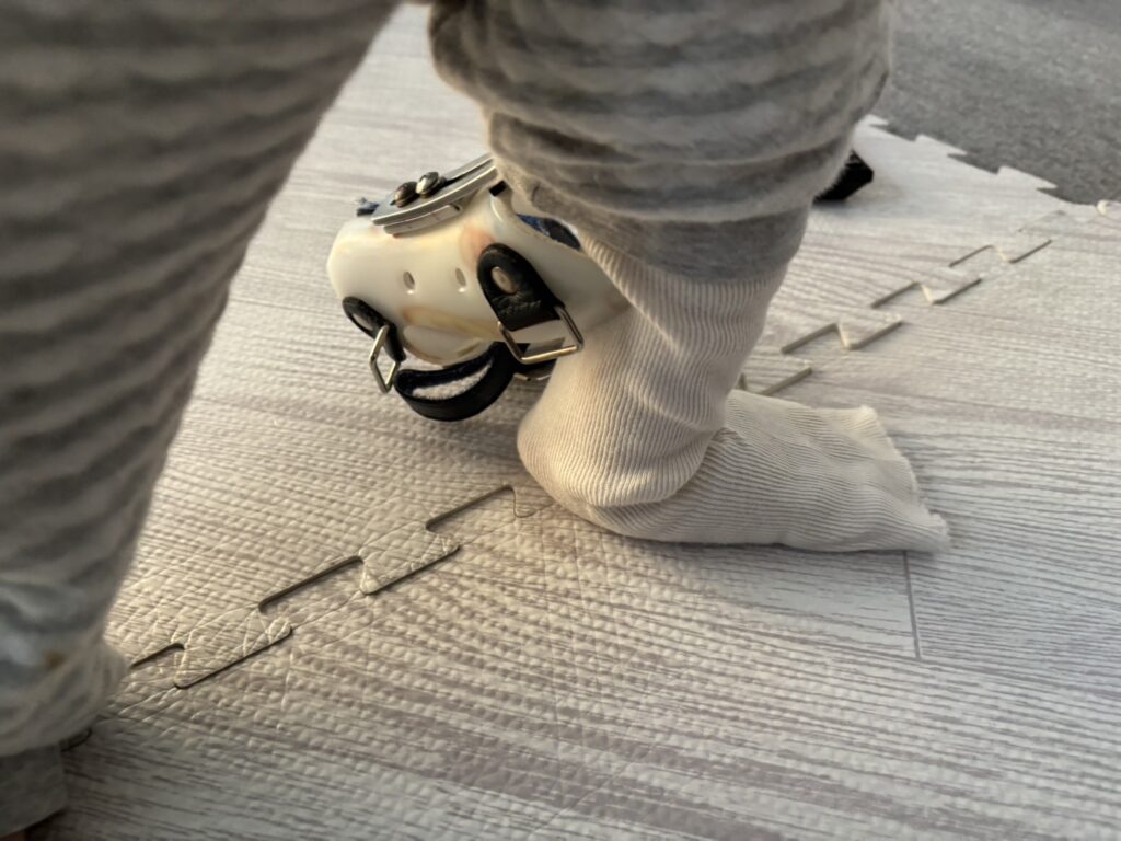 装具外して立ってた2