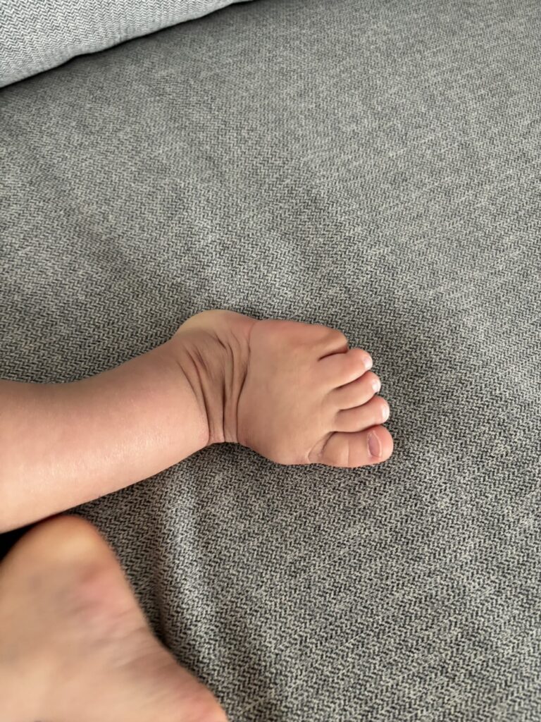 1歳半_足の状態3