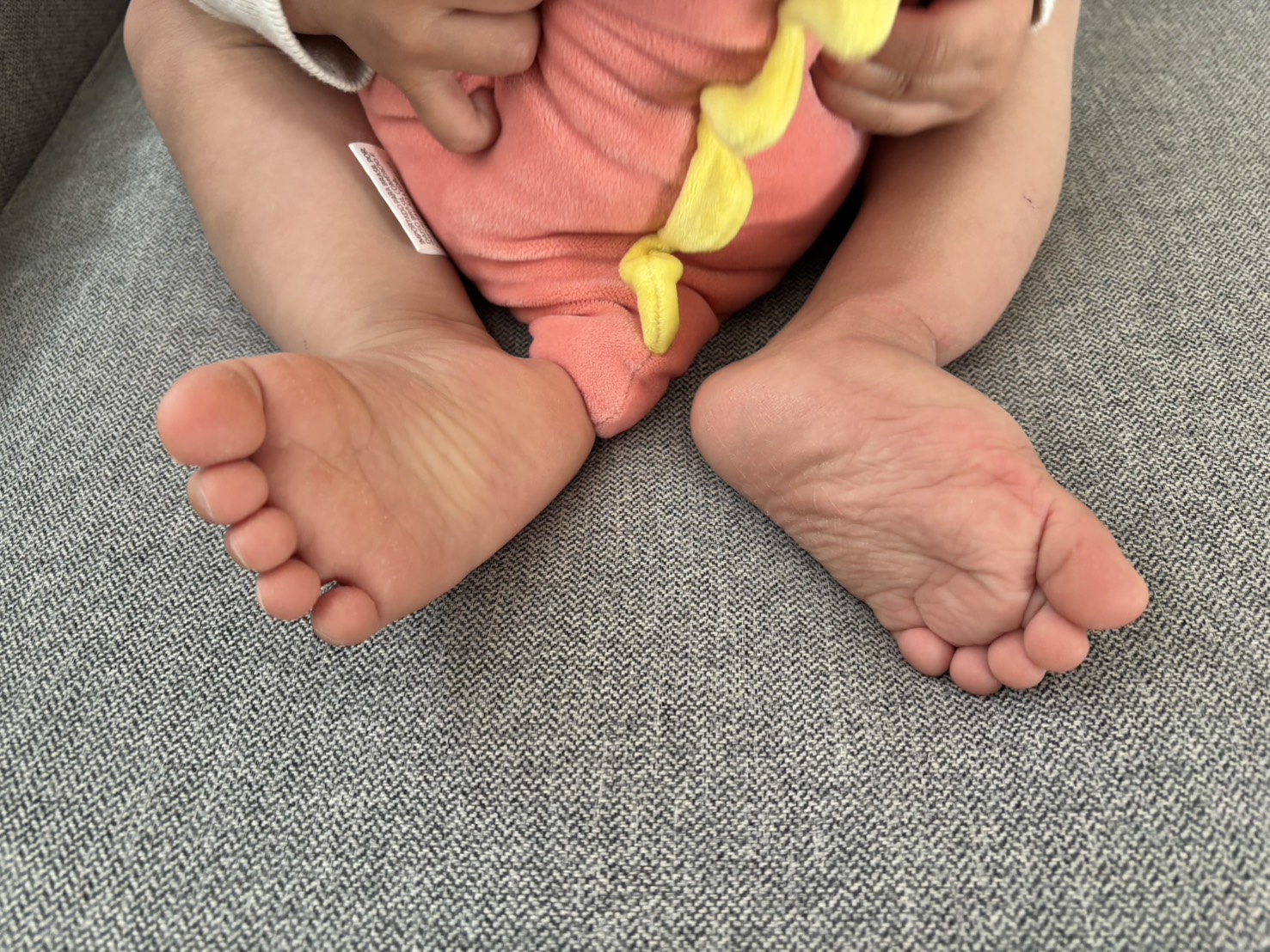 1歳半_足の状態1